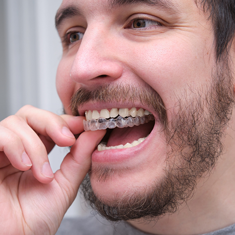 Man placing Invisalign over his teeth