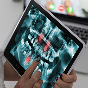 Person holding a tablet showing an x ray of teeth